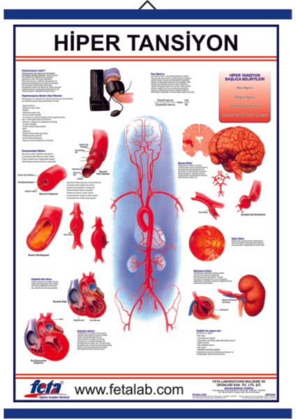 Hipertansiyon Eğitim Plakası