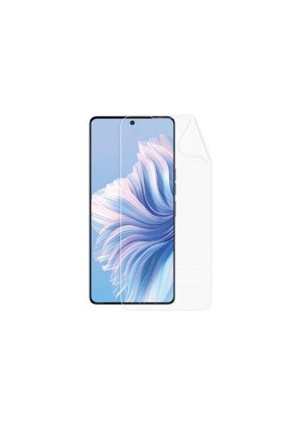 Tecno Camon 20 Pro Ekran Koruyucu Poliüretan Film