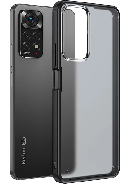 Xiaomi Redmi Note 11 Pro 5g Kılıf Mat Volks Case