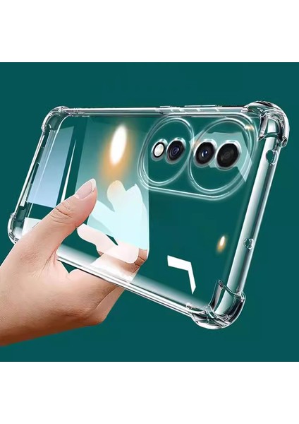 Honor 90 Hava Yastığı Düşme Önleyici Tpu Cep Telefonu Kılıfı (Yurt Dışından)