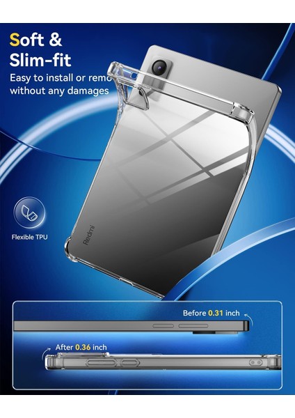 Redmi Pad Se 11 Inç Tablet Kılıfı ve Ekran Koruyucu Nano Cam Set Ön Arka Tam Kaplama 2 In 1