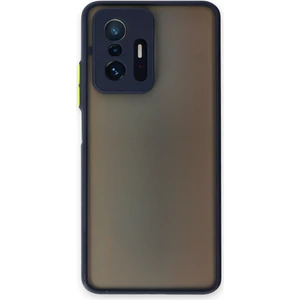 Caseart Xiaomi Mi 11T Pro Kılıf Kamera Korumalı Silikon Kenarlı Renkli Düğmeli Arkası Mat Arka Kapak - Lacivert