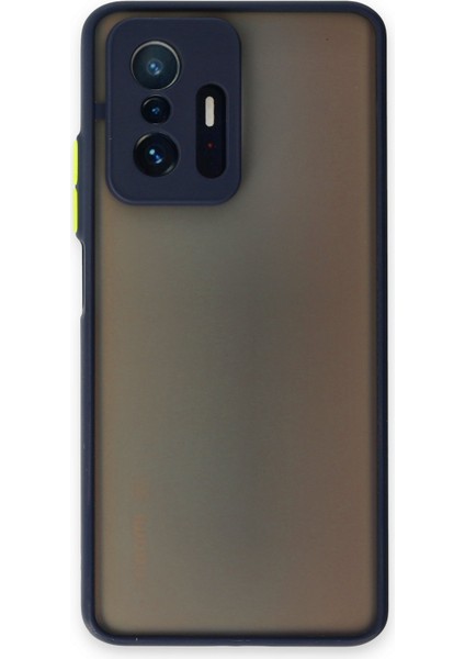 Caseworld Xiaomi Mi 11T Pro Kılıf Kamera Korumalı Silikon Kenarlı Renkli Düğmeli Arkası Mat Arka Kapak - Lacivert
