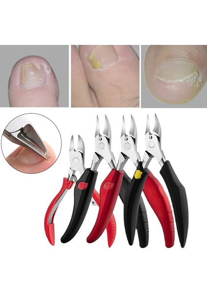 Stylec2 Ayak Tırnağı Tırnak Makası Kesiciler Paslanmaz Çelik Ayak Tırnağı Batık Ölü Cilt Sökücü Tırnak Makası Manikür Paronişi Düzeltme Aracı (Yurt Dışından) modelleri