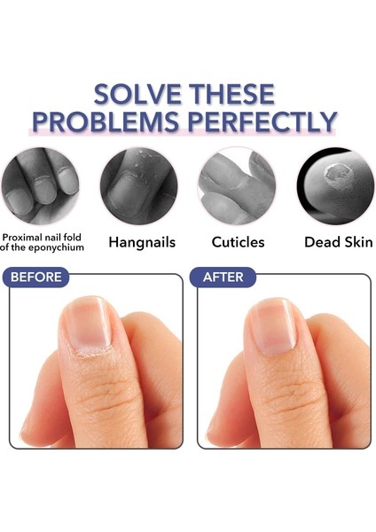 Color-1 Paslanmaz Çelik Tırnak Eti Makası Profesyonel Sökücü Makas Parmak Bakımı Manikür Tırnak Makası Ölü Cilt Araçları Altın (Yurt Dışından) fırsatları