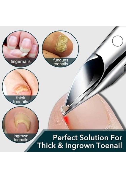 Siyah 1 Adet Kalın Ayak Tırnağı Giyotin Clipper Paslanmaz Çelik Profesyonel Paronychia Batık Tırnak Kesici Manikür Ayak Bakımı Pedikür Aracı (Yurt Dışından)