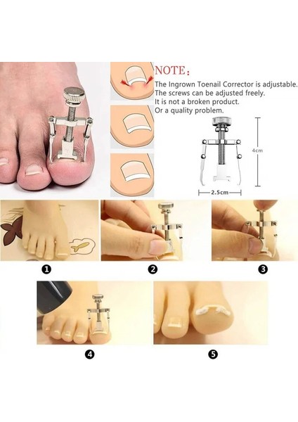 12 Adet 12 Adet/takım Profesyonel Pedikür Araçları Batık Ayak Tırnağı Araçları Seti Tırnak Bakımı Batık Ayak Tırnağı Kaldırma Düzeltme Makası Ayak Bakımı (Yurt Dışından) indirimleri