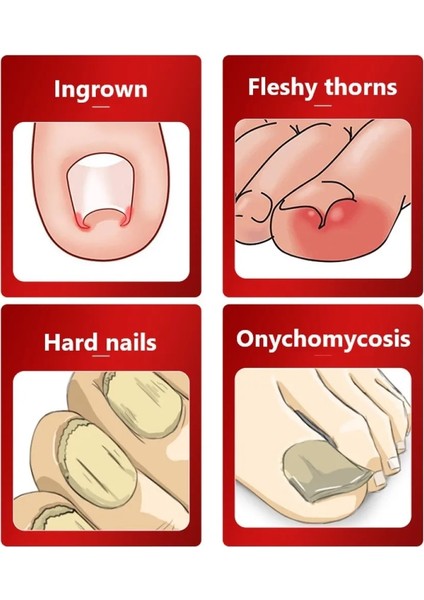 Kırmızı 1 Adet Paslanmaz Çelik Ayak Tırnağı Batık Tırnak Sanat Makası Makas Paronychia Ölü Cilt Sökücü Kırpma Tırnak Makası Pedikür Araçları (Yurt Dışından) fiyatları