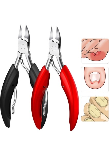 Kırmızı 1 Adet Paslanmaz Çelik Ayak Tırnağı Batık Tırnak Sanat Makası Makas Paronychia Ölü Cilt Sökücü Kırpma Tırnak Makası Pedikür Araçları (Yurt Dışından) modelleri