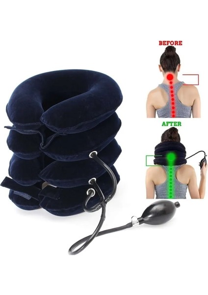 4 Katmanlı Şişme Servikal Traksiyon Cihazı Ev Servikal Vertebra Ortez Boyun Boyunluk Boyun Sedye (Yurt Dışından) fiyatları
