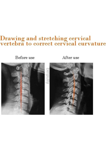 Isıtma Yok 220V Doğal Turmalin Masajı Boyun Yastığı Sırt Bel Uzak Kızılötesi Terapi Servikal Traksiyon Masajı Sağlık Gevşeme (Yurt Dışından) fırsatları