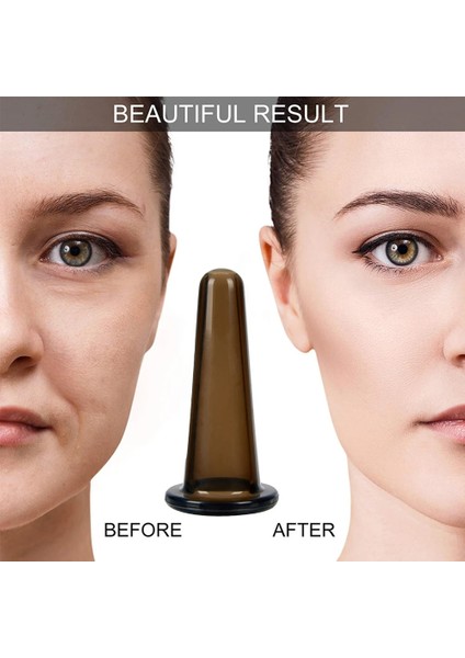 Pembe-3-4 Silika Masaj Vücut Bardak Yüz Vantuz Anti Selülit Vakum Çukurluğu Kutular Sırt Masajı Kavanoz Çin Fizyoterapi Kiti (Yurt Dışından) modelleri