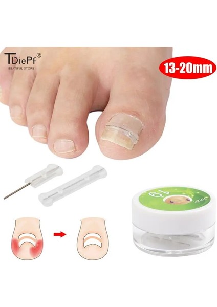 20MM 10 Adet 1 Kutu 10 Adet/kutu Batık Ayak Tırnağı Düzeltme Aracı Batık Ayak Tırnak Tedavisi Elastik Yama Etiket Doğrultma Klip Brace Pedikür Aracı (Yurt Dışından)