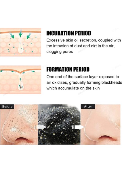 BLACK-100PCS 10-100PCS Burun Remover Maske Derin Temizleyici Cilt Bakımı leri Küçültmek Akne Tedavisi Maskesi Burun lar Temiz Şeritler (Yurt Dışından) fırsatları