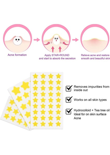 Bir Yıldız Sivilce Yama Akne Renkli Görünmez Akne Temizleme Cilt Bakımı Çıkartmalar Y2K Özgünlük Kapatıcı Yüz Nokta Güzellik Makyaj Aracı (Yurt Dışından) modelleri