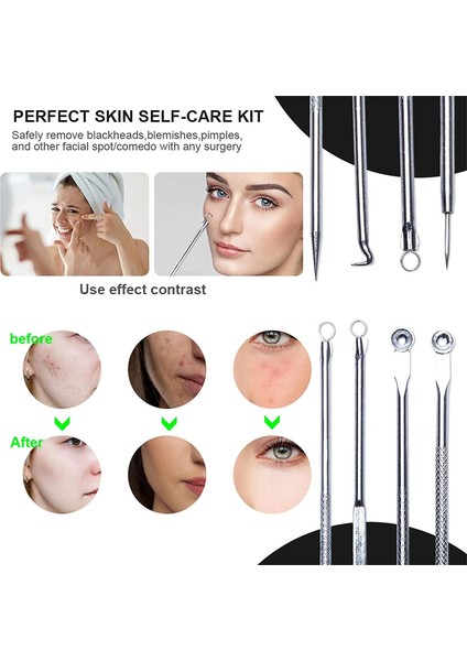 Set C 4pcs Siyah Nokta Akne Sökücü Komedon Siyah Nokta Leke Sivilce Kaldırma Iğnesi Yüz Bakımı Cilt Temizleme Gözenek Temizleyici Güzellik (Yurt Dışından)