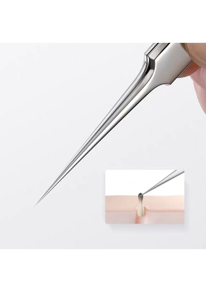 Konik Hiçbir Kutu Alman Ultra-Ince No.5 Hücre Sivilce Siyah Nokta Klip 0.1mm Siyah Nokta Remover Cımbız Siyah Noktalar Gözenek Temizleyici Akne Iğne Aracı (Yurt Dışından) fırsatları