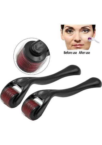0.2mm Siyah Drs 540 Dermaroller Mikro Iğneler 0.2/0.25/0.3mm Uzunluk Titanyum Dermoroller Microniddle Roller Yüz Cilt Bakımı Tedavisi Için (Yurt Dışından) fiyatları