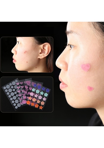 Pembe Yıldız Yıldız Sivilce Yama Akne Renkli Görünmez Akne Kaldırma Cilt Bakımı Çıkartmalar Y2K Özgünlük Kapatıcı Yüz Nokta Güzellik Makyaj Aracı (Yurt Dışından) indirimleri