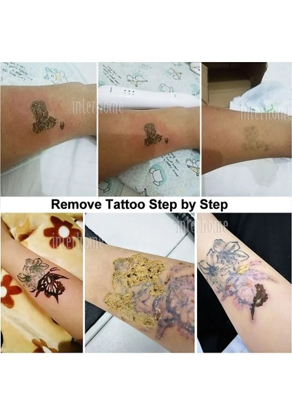 Beyaz Orijinal Elektrikli Koter Köstebek Temizleme Makinesi Güzellik Yüz Spa Masaj Lazer Dövme Temizleme Kalemi Cilt Etiketi Düz Siğiller Sökücü (Yurt Dışından) modelleri