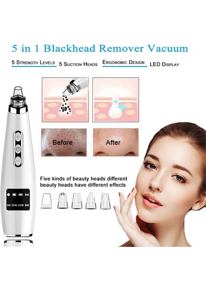 Hıçbır Kutu Tinwong Siyah Nokta Çıkarıcı Vakum, Elektrikli Yüz Comedo Emme Gözenek Temizleyici Çıkarıcı Aracı, 5 Değiştirilebilir Emme Kafaları (Yurt Dışından) fiyatları