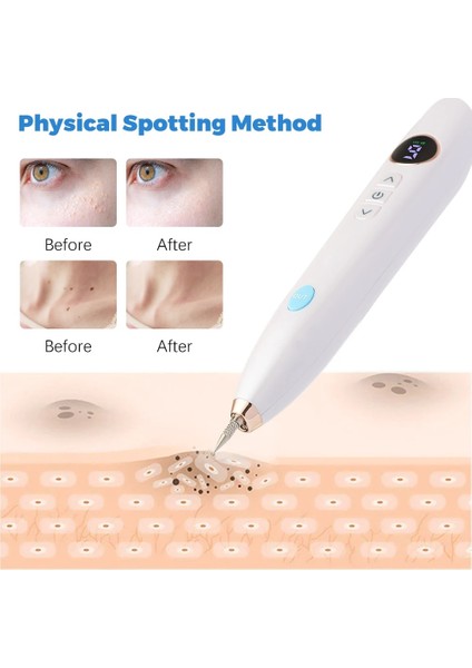 C Stil Elektrikli Köstebek Sökücü Plazma Kalem Lazer Siğiller Cilt Etiketi Kaldırma LCD Nevus Dövme Siyah Noktalar Kaldırma Leke Dövme Çıkarıcı Kalem (Yurt Dışından) fiyatları