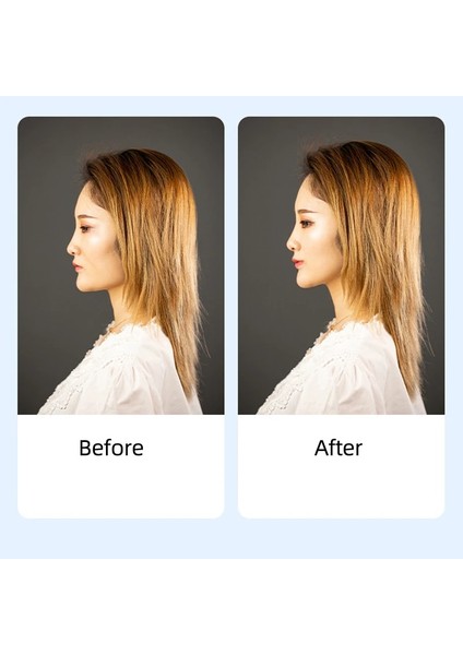 Anında Yüz Göz Gerdirme Için Bej 1 Bantlı Görünmez Saç Tokası, Ameliyatsız Balık Kuyruğu Kırışıklıklarını Giderir, Yeniden Kullanılabilir Yüz Gerdirme Elastik Bandı (Yurt Dışından) fırsatları