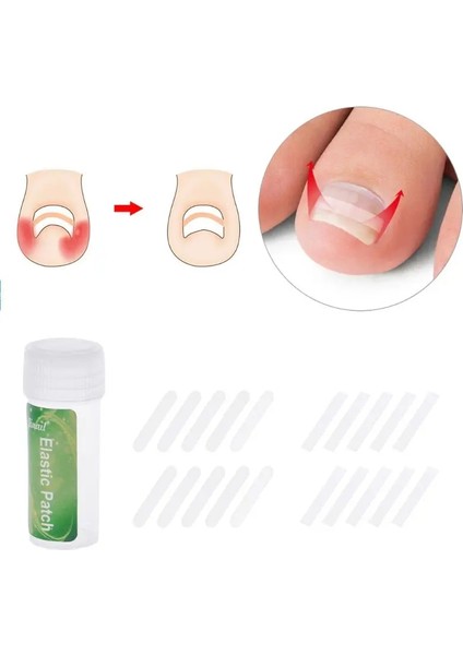 4 10 Adet Batık Ayak Tırnaklarını Tedavisi Doğrultma Bandı Kavisli Klip Brace Yama Tırnak Kama Paronişi Kaldırıcı Kurtarmak (Yurt Dışından) fiyatları