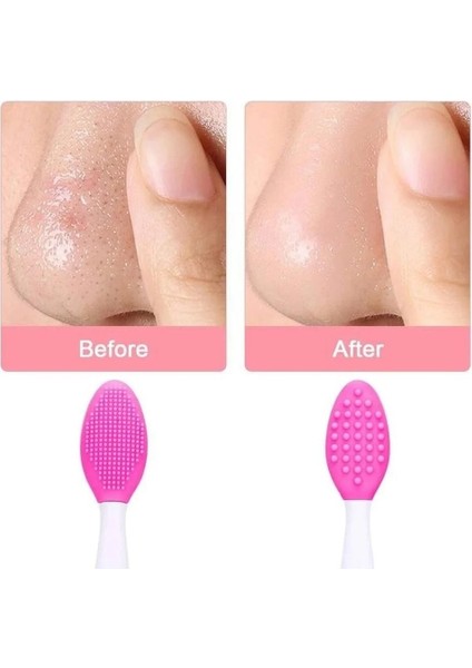 Sarı 10 Adetyumuşak Siyah Nokta Çıkarıcı Dudak Peeling Fırçası Güvenli Çift Taraflı Yıkama Yüz Fırçası Fırçalama Yıkama Makyaj Fırçası Siyah Nokta Çıkarıcı (Yurt Dışından)