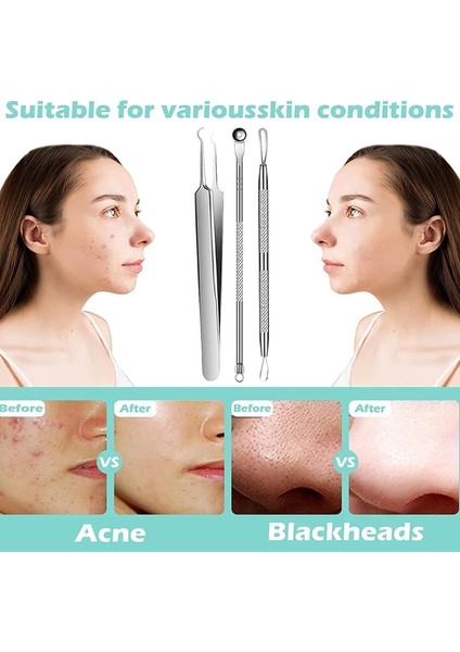 7pcs-Withbox Siyah Nokta Remover Araçları Sivilce Popper Araç Seti Akne Çıkarıcı Aracı Profesyonel Paslanmaz Sivilce Akne Leke Temizleme Aletler Set (Yurt Dışından)