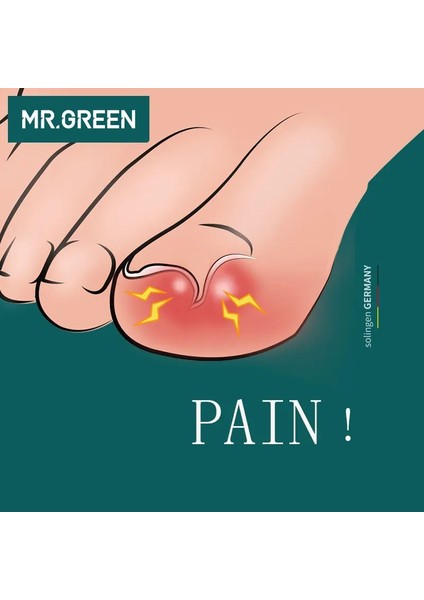 MR-1026BK Mr.green Ayak Yeni Profesyonel Paslanmaz Çelik Manikür Giyotin Sanat Pense Tırnak Eti Makası Tırnak Makası Tırnak Kesici (Yurt Dışından) indirimleri