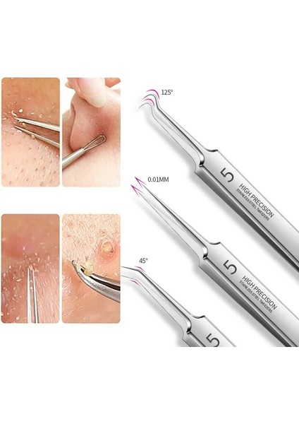 4 Adet Alman Ultra-Ince No. 5 Hücre Sivilce Siyah Nokta Klip Cımbız Güzellik Yüz Sağlık Salonu Özel Siyah Nokta Çıkarıcı Akne Iğne Aracı (Yurt Dışından)