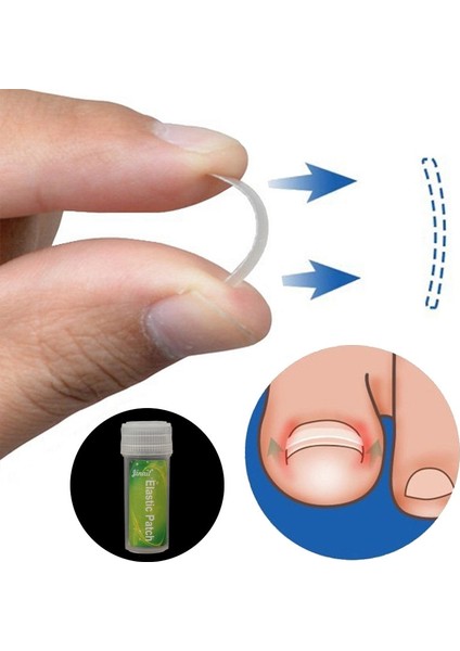 3.5X24MM Ayak Bakımı Araçları Tırnak Yama Ekleme Tırnak Düzeltme Yama Pull-Up Ters Gerginlik Düzeltici Tırnak Brace Kişisel Sağlık (Yurt Dışından)