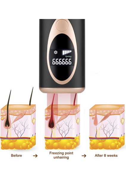 Siyah Epilasyon Lazer Epilatör Kadınlar Için Flaş Depilatör Bakliyat Kalıcı Lazer Epilatör Ağrısız Epilasyon Ev Kullanımı (Yurt Dışından) fırsatları