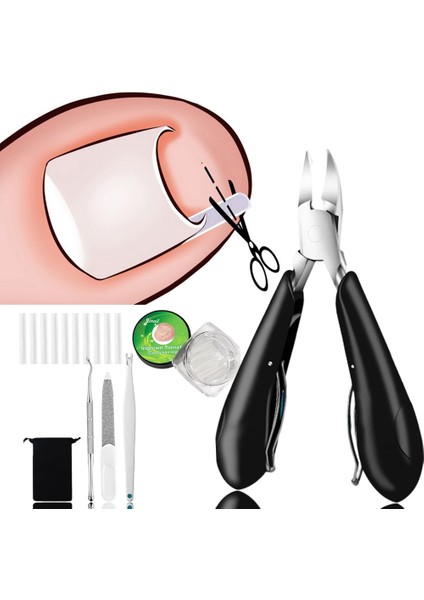Set C 10 Adet Batık Ayak Tırnağı Düzeltme Aracı Tırnak Tedavisi Ayak Tırnak Etiket Ayak Bakımı Pedikür Ayak Ortodonti Ayak Başparmak Tırnak Yamaları (Yurt Dışından)