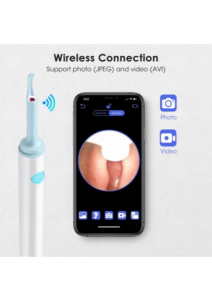 Tip 2 (3.9mm) Akıllı Görsel Kulak Çubukları Kulak Temizleme Endoskopu 500W Yüksek Hassasiyetli Earpick Mini Kamera Otoskop Sağlık Kulak Temizleyici (Yurt Dışından)