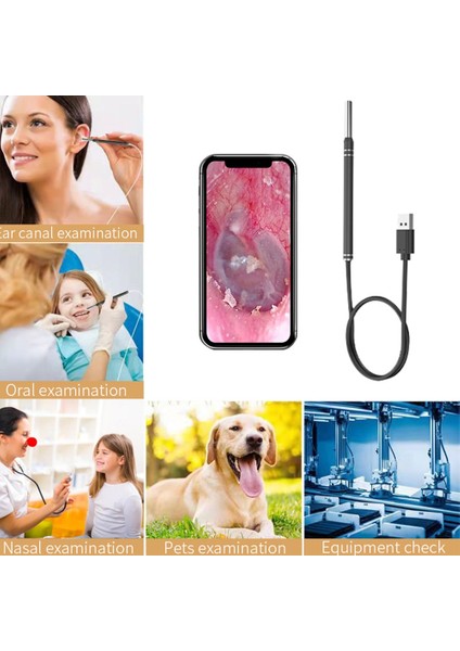 Tip 2 Siyah 5 mm Hd Görsel Kulak Endoskop 3 In 1 USB Otoskop Kulak Kiri Temizleme Muayene Kamera Araçları Android Telefon Pc Için (Yurt Dışından) modelleri