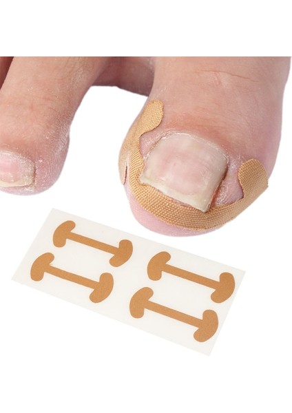 Tırnak Welt Bant-4pcs 10 Adet Tırnak Düzeltme Çıkartmalar Tedavisi Paronychia Kurtarma Aracı Batık Ayak Tırnağı Düzeltme Elastik Yama Brace Pedikür Aracı (Yurt Dışından)