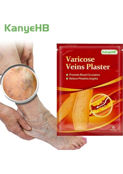 6pcs-D Varisli Damarlar Vaskülit Yama Vasküler Damarlar Sökücü Örümcek Bacaklar Tedavisi Çin Tıbbi Alçı Angiitis Çıkartmalar Cilt Bakımı (Yurt Dışından)