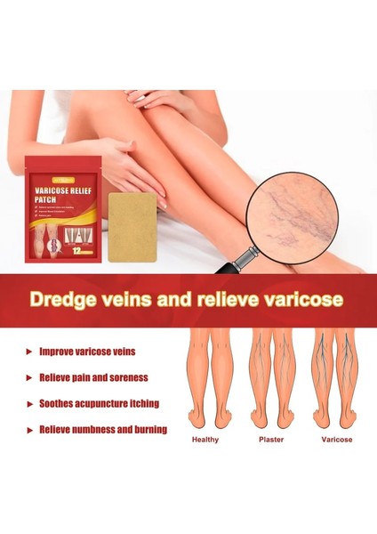 6pcs-D Varisli Damarlar Vaskülit Yama Vasküler Damarlar Sökücü Örümcek Bacaklar Tedavisi Çin Tıbbi Alçı Angiitis Çıkartmalar Cilt Bakımı (Yurt Dışından)