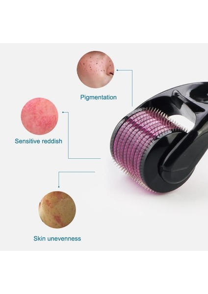 Siyah 0.25MM Darsonval 540 Derma Silindiri Saf Mikro Iğneleme 0.2/0.25/0.3mm Iğneler Uzunluk Titanyum Dermoroller Yüz Için Mikroniddle Silindir (Yurt Dışından) fırsatları