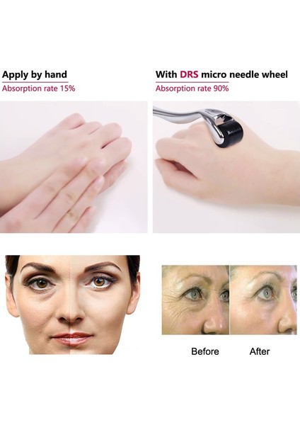 Siyah 0.25MM Darsonval 540 Derma Silindiri Saf Mikro Iğneleme 0.2/0.25/0.3mm Iğneler Uzunluk Titanyum Dermoroller Yüz Için Mikroniddle Silindir (Yurt Dışından) indirimleri