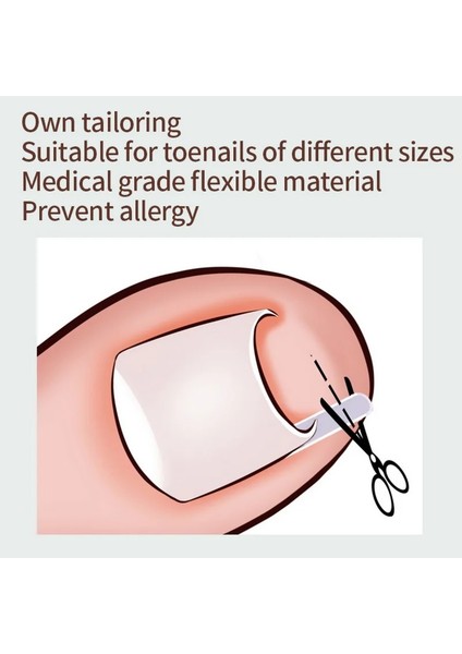 10 Adet 10 Adet Batık Ayak Tırnağı Düzeltme Aracı Batık Ayak Tırnak Tedavisi Elastik Yama Etiket Doğrultma Klip Brace Pedikür Aracı (Yurt Dışından)