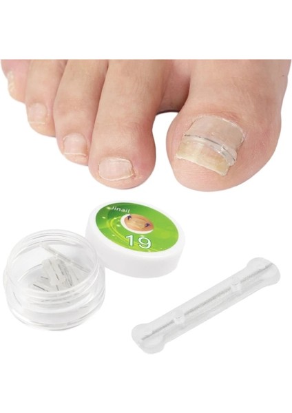 20MM 10 Adet Batık Ayak Tırnağı Düzeltici Şeritler Brace Batık Ayak Tırnağı Pedikür Aracı Ayak Tırnağı Düzeltme Yama Kadın Erkek Için (Yurt Dışından) fiyatları