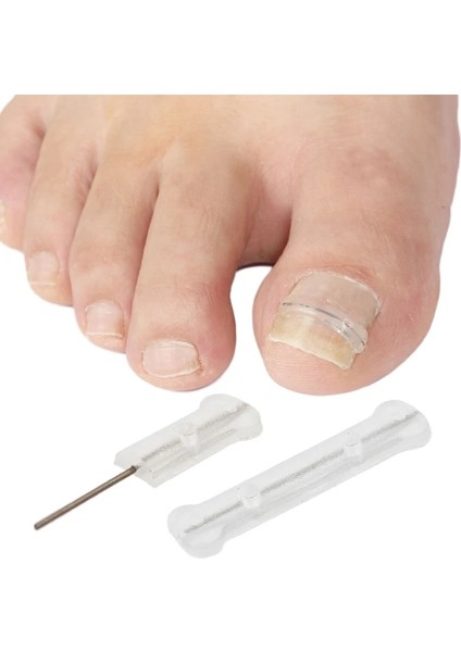 20MM 10 Adet Batık Ayak Tırnağı Düzeltici Şeritler Brace Batık Ayak Tırnağı Pedikür Aracı Ayak Tırnağı Düzeltme Yama Kadın Erkek Için (Yurt Dışından) modelleri