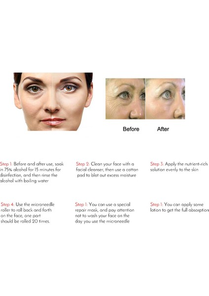 Siyah 0.25 mm 540 Iğneler Mikro Iğne Derma Rulo Tıbbi Terapi Cilt 0.2MM/0.25MM/0.3MM Iğne Uzunluğu Vücut Güzellik Bakım Aracı Altın Gümüş (Yurt Dışından) fırsatları