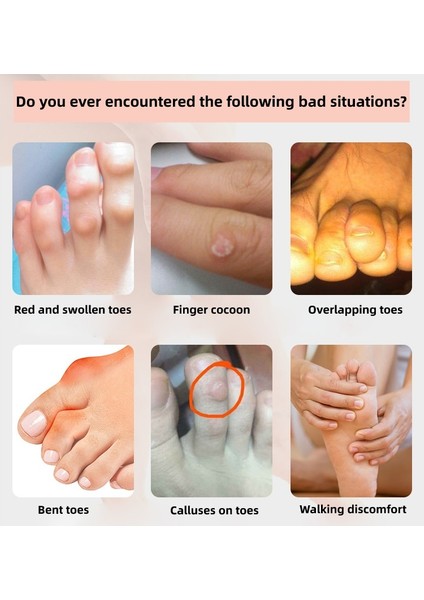 1.8x1.2 cm 2 Adet Beyaz 2/4/6 Adet Silikon Jel Küçük Ayak Tüpü Mısır Kabarcıklar Düzeltici Pinkie Koruyucu Jel Bunyon Ayak Parmak Koruma Jel Kol (Yurt Dışından) modelleri