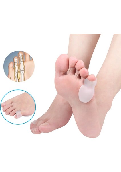 Ten Rengi Sequstep Küçük Ayak Parmağı Ayırıcı Bunyon Koruyucu Serçe Parmak Düzeltici Çakışan Çarpık Ayak Parmakları Sedye Düzleştiriciler (Yurt Dışından)