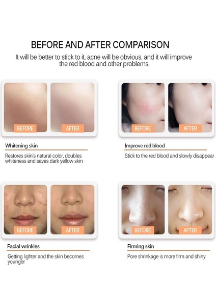 Yuvarlak Nano 10 Adet Derma Haddeleme Kalem Mym Mikro Iğne Kalemi Mikro Vida Bağlantı Noktası Iğne Kartuşu Bb Kızdırma Cihazı Kablolu Elektrikli Derma Araçları Mts (Yurt Dışından) fırsatları