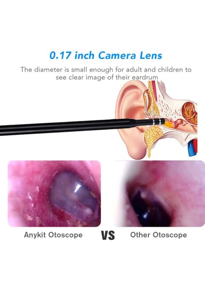 3.0mm (Tip C) Akıllı Hd Görsel Kulak Kiri Temizleme Kulak Temizleyici Kulak Sopa Endoskop Earpick Dijital Otoskop Kulak Kiri Temizleme Aracı Kamera ile (Yurt Dışından) fırsatları